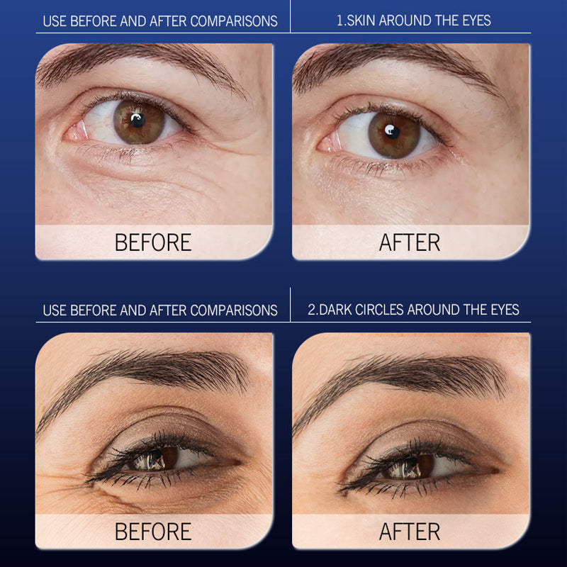 Newyuo™ LuminaLift Eye Serum