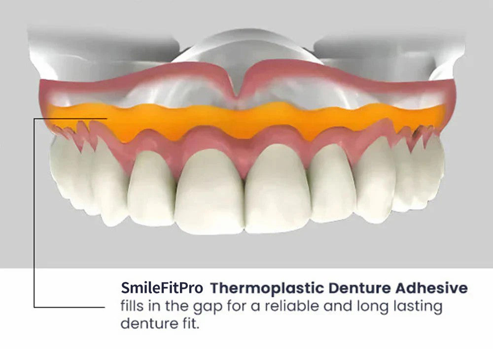 SmileFitPro® Thermoplastic Denture Adhesive ⏳ Durable Denture Retention