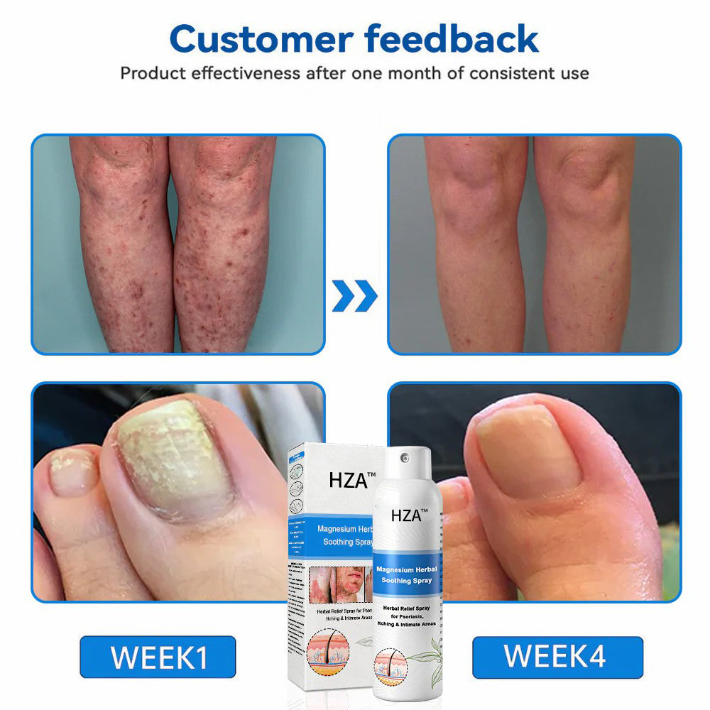 ✅ Official Store: HZA™ Magnesium Herbal Psoriasis Spray ⚕️ FDA Certified