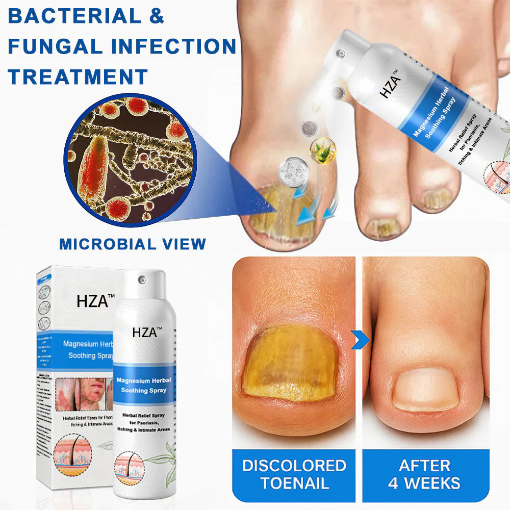 ✅ Official Store: HZA™ Magnesium Herbal Psoriasis Spray ⚕️ FDA Certified