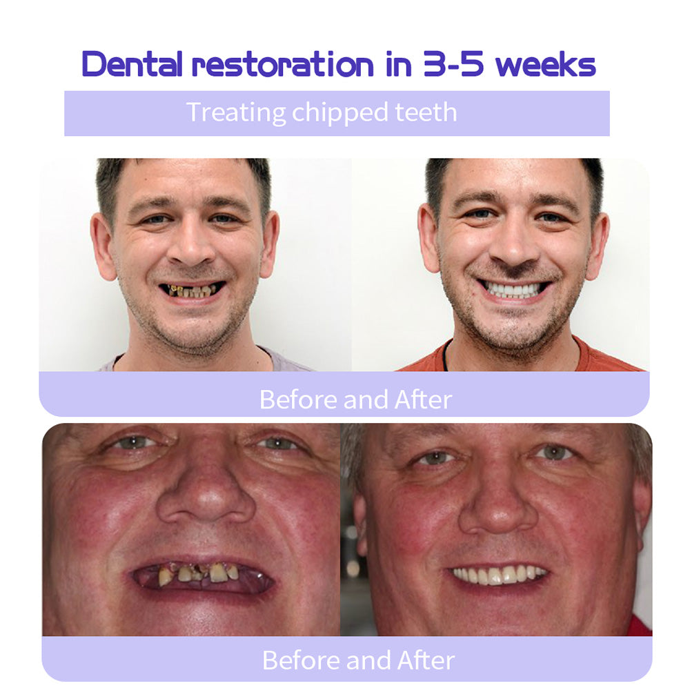 š„HistoneĀ® Fluoride-Free Hydroxyapatite Enamel Repairing Breath Freshening Whitening Toothpaste