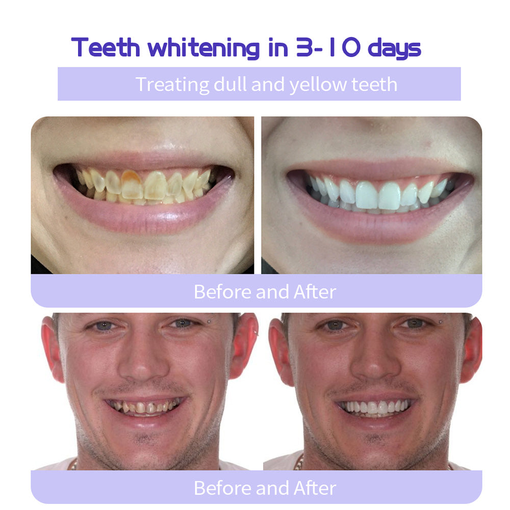 š„HistoneĀ® Fluoride-Free Hydroxyapatite Enamel Repairing Breath Freshening Whitening Toothpaste