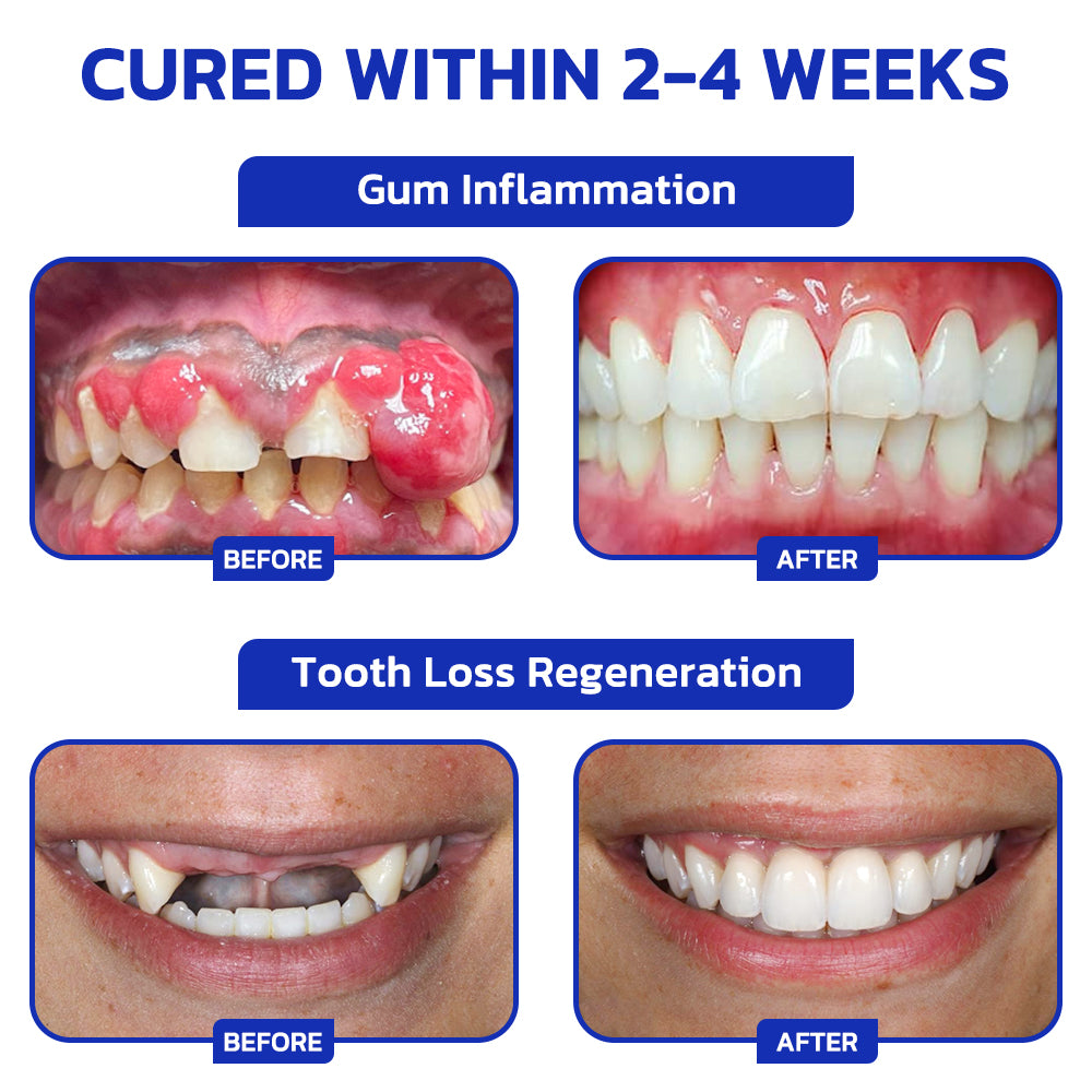 BBOJI™ BrightSmile Whitening Tabs