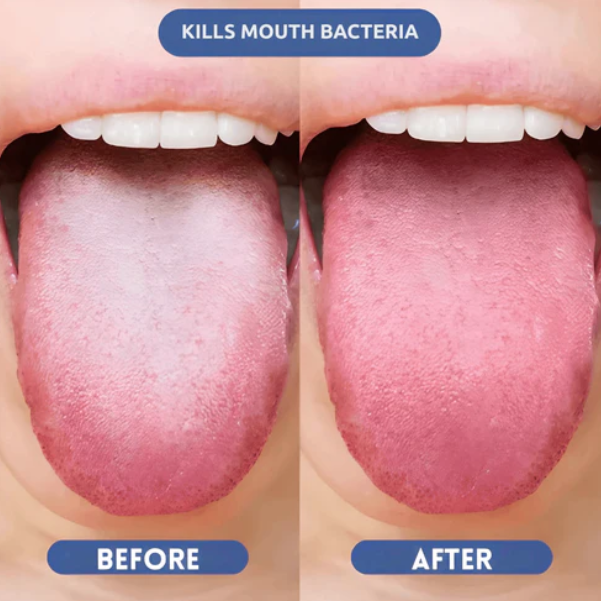Smileasego™ Probiotic Oral Mist