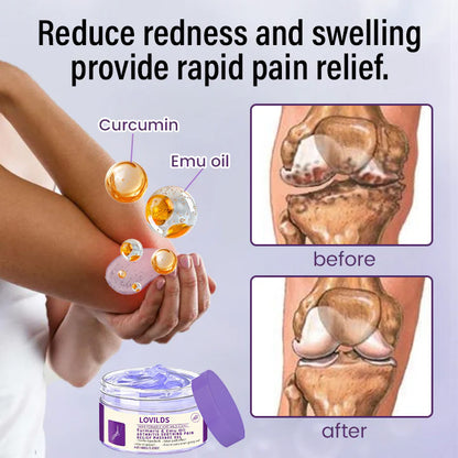 LOVILDS™ Arthritis Relief Gel: Turmeric & Emu Oil for Fast Soothing Relief