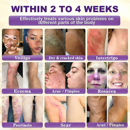 Made and Shipped from UK ✨LOVILDS® Biotin 10-in-1 Skin Restoration Cream🌻🌻