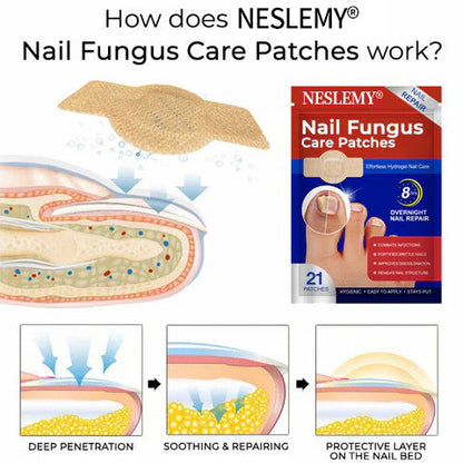 NESLEMY® Nail Fungus Care Patches