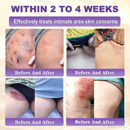 Made and Shipped from UK ✨LOVILDS® Biotin 10-in-1 Skin Restoration Cream🌻🌻