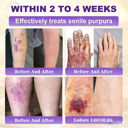 Made and Shipped from UK ✨LOVILDS® Biotin 10-in-1 Skin Restoration Cream🌻🌻